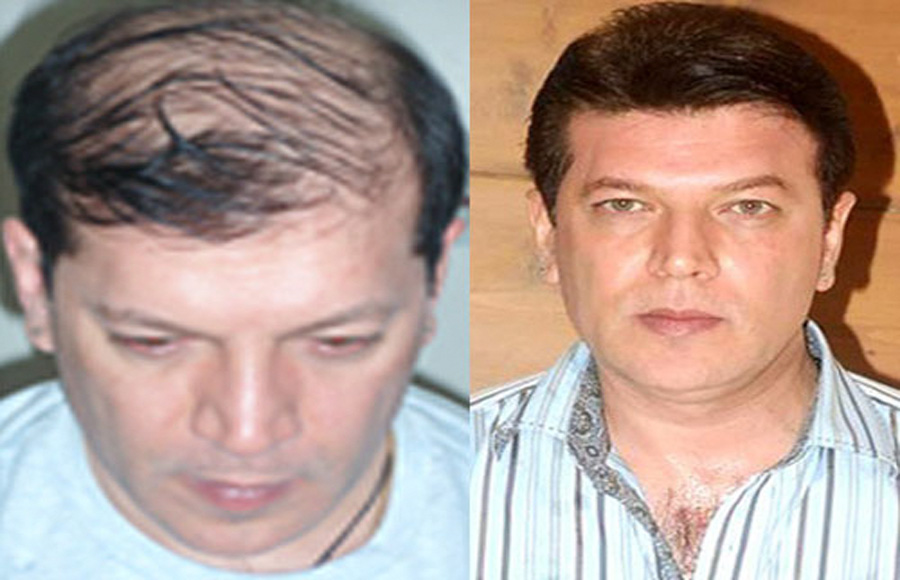 Aditya Pancholi